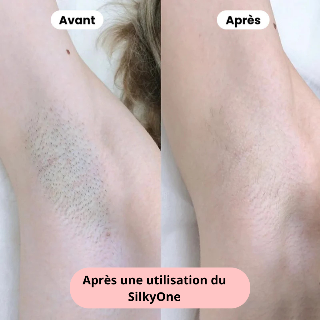 Résultat avant et après utilisation du rasoir tondeuse SilkyOne™ d’Épilae – peau douce et sans poils
